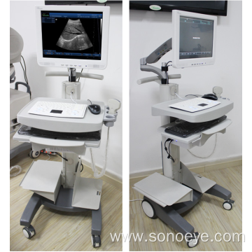 Trolley type ultrasound machine for clinic